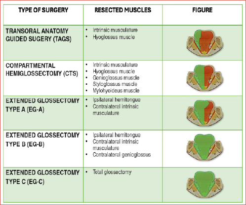 Various surgical approaches to oral tongue/floor of mouth squamous cell carcinoma according to a modular and compartment-based concept.