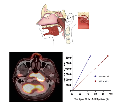 Role of PET/CT in improving the cost-effectiveness of nimotuzumab in nasopharyngeal carcinoma.